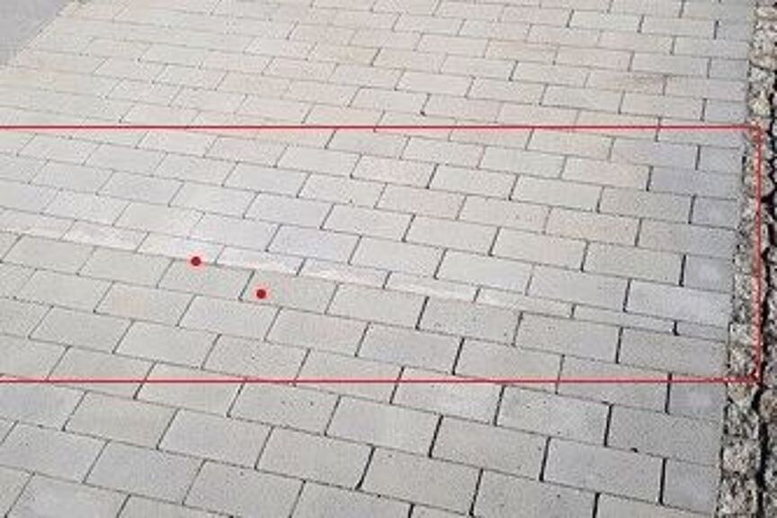 Richtige Pflasterung mit “Denkmal-Naht” Richtige Pflasterung mit “Denkmal-Naht”